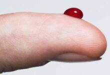 تأثيرات نفسية لرؤية الدم في الحلم