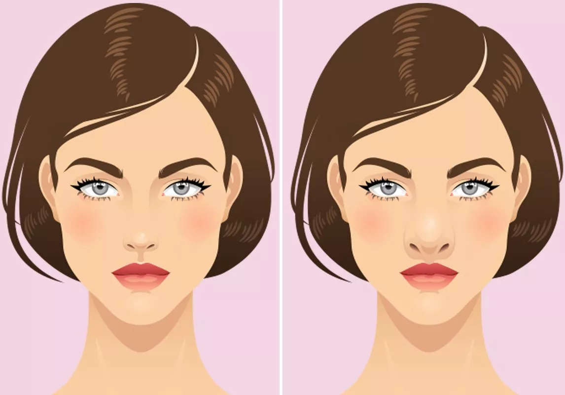 تصغير الأنف بشكل طبيعي