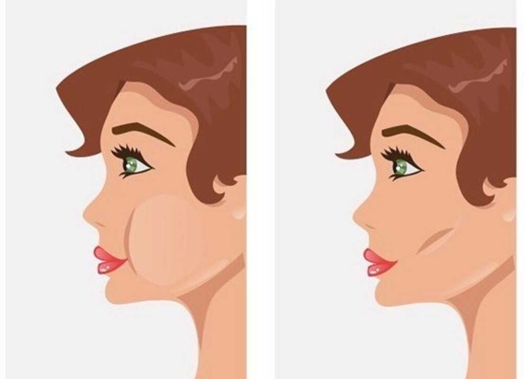 تصغير الأنف بشكل طبيعي: أسرار وحيل مجربة لنتائج فعالة دون جراحة